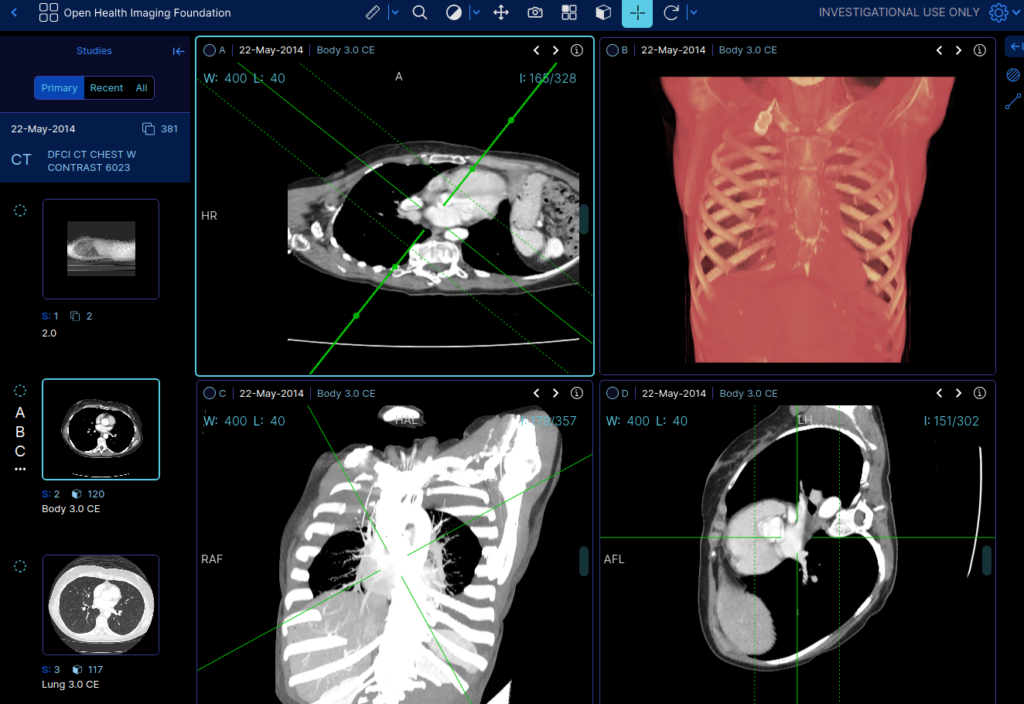 Radiology Volume Rendering